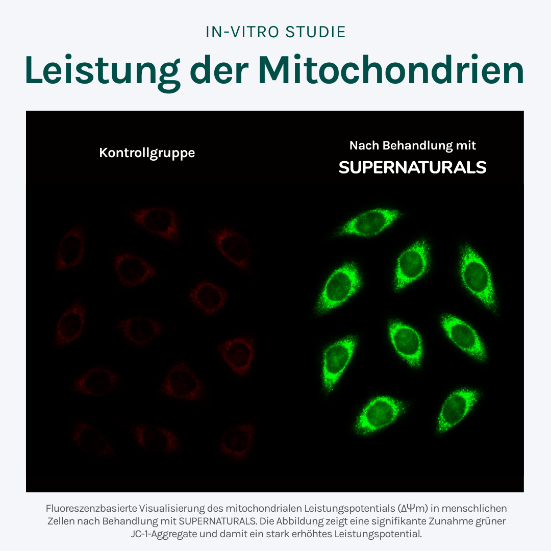 Supernaturals SuperME - 90 Tage